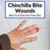 Chinchilla Bite Wounds (Both To A Chin And From One)